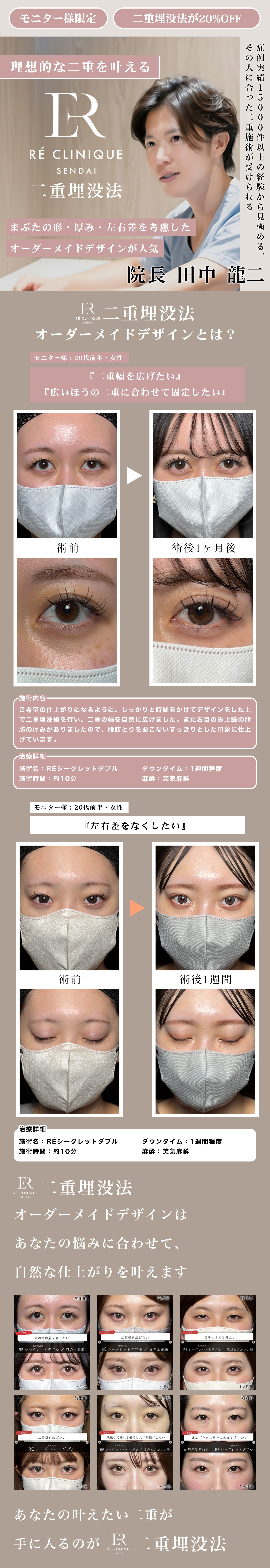 RÉ CLINIQUE SENDAI 二重埋没法 キャンペーン