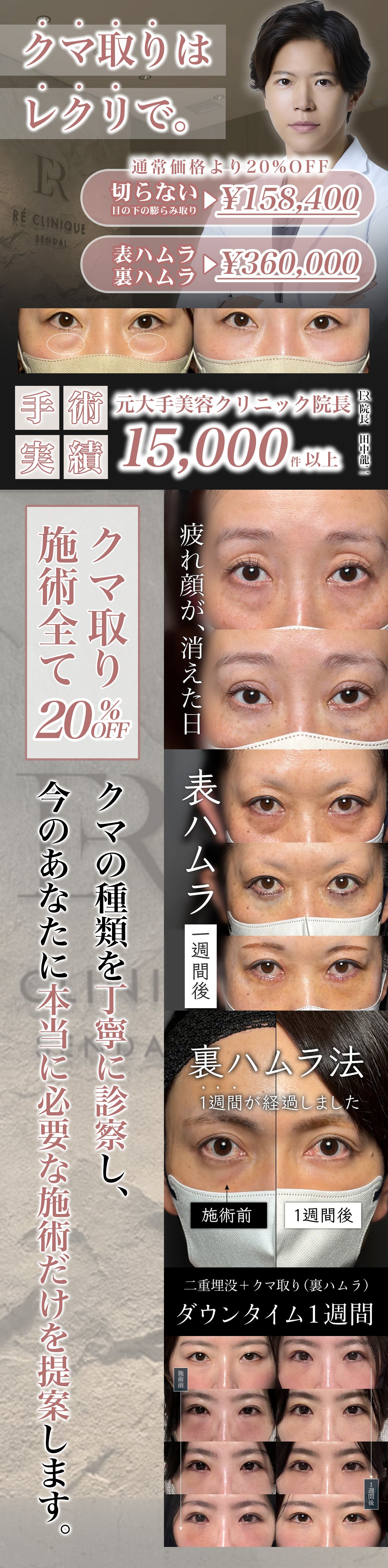 RÉ CLINIQUE SENDAI クマ取りキャンペーン