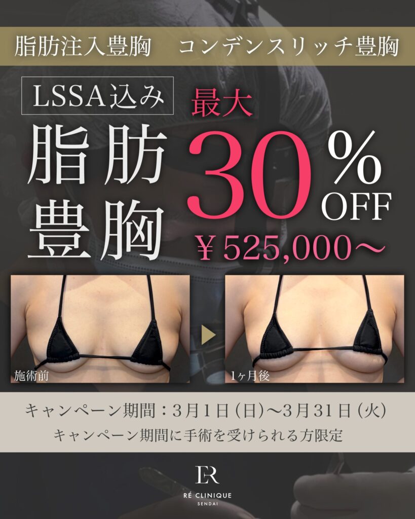 【3月限定】今月のおすすめ治療のご案内|脂肪豊胸
