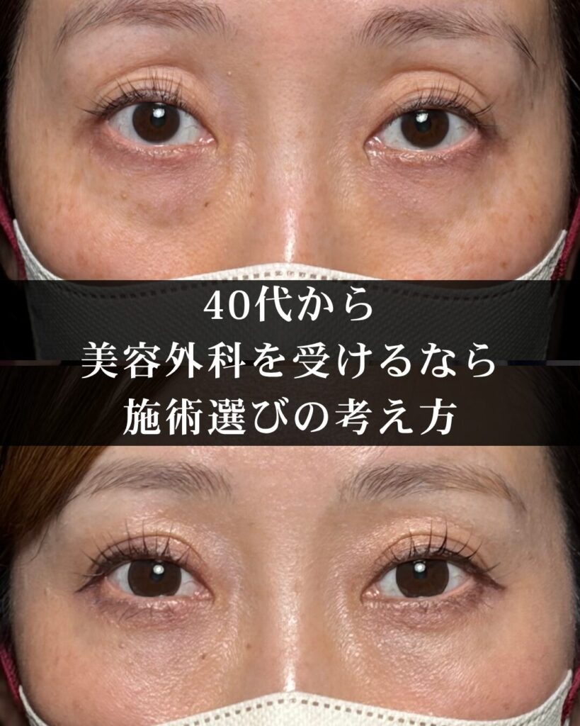 40代から仙台で美容外科を受けるなら。若い世代と違う施術選びの考え方
