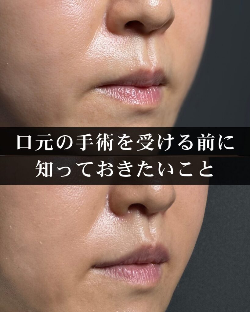 仙台で口元の手術を受ける前に知っておきたいこと。失敗しないための完全ガイド