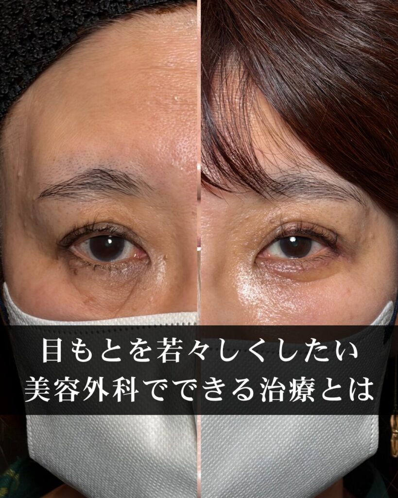 仙台で目もとの印象を若々しくしたい方へ。美容外科でできる治療とは