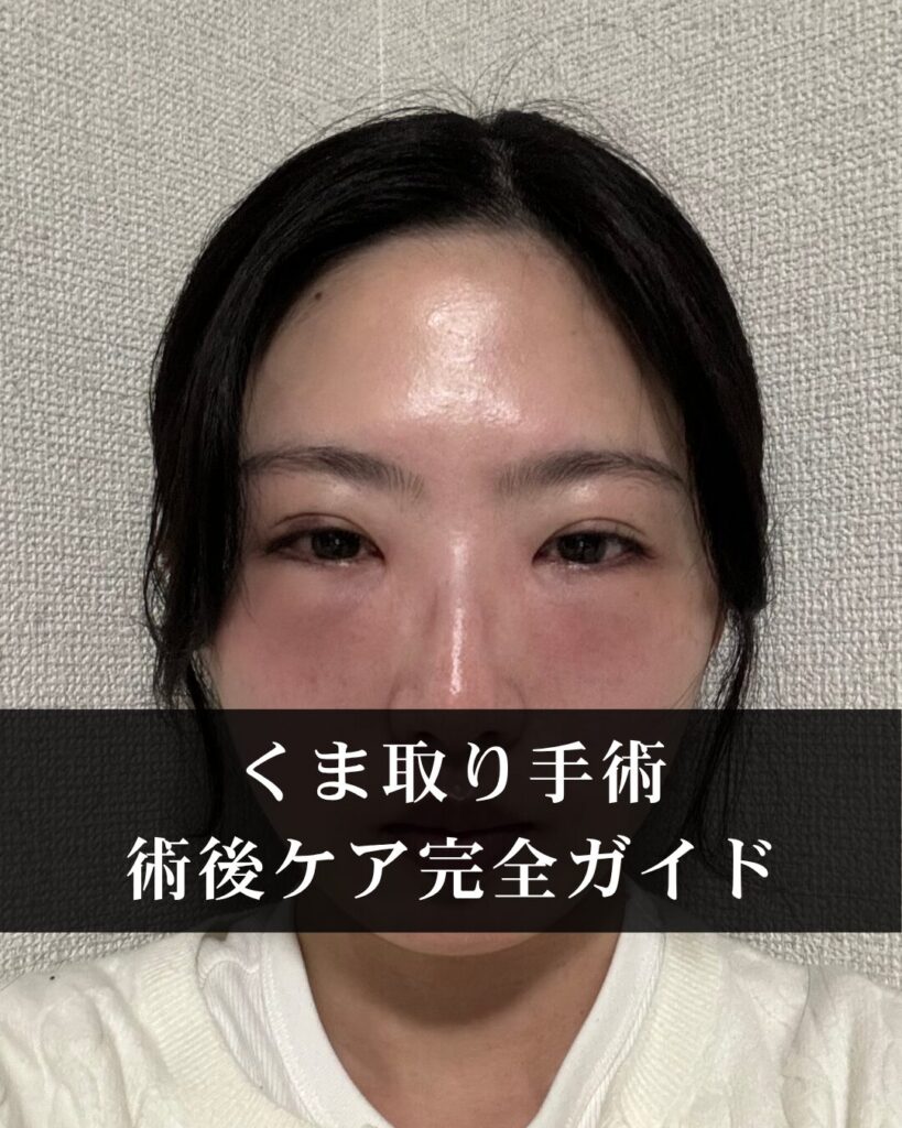 くまとり手術後に注意すべき症状と対処法。術後ケアの完全ガイド