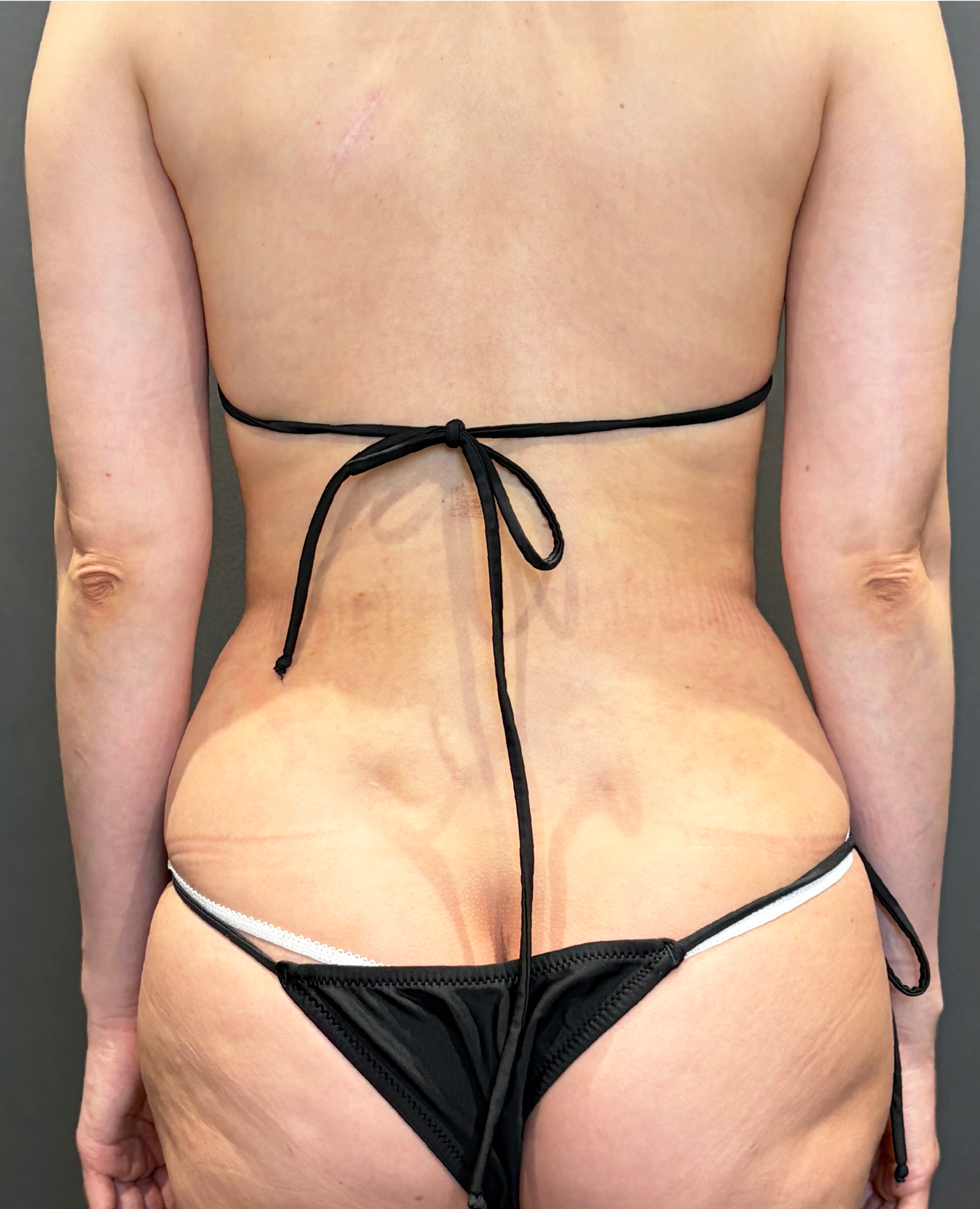 After image