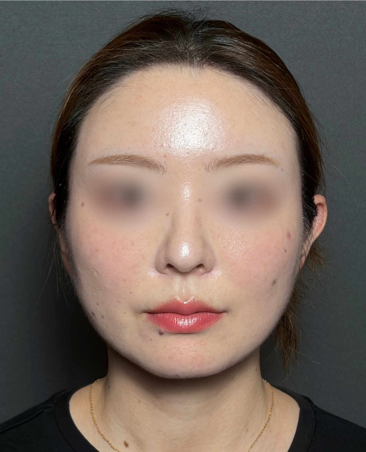 After image