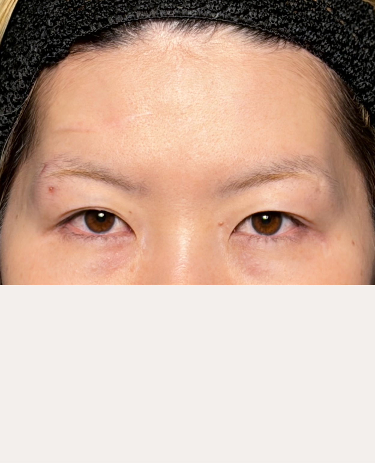 Before image