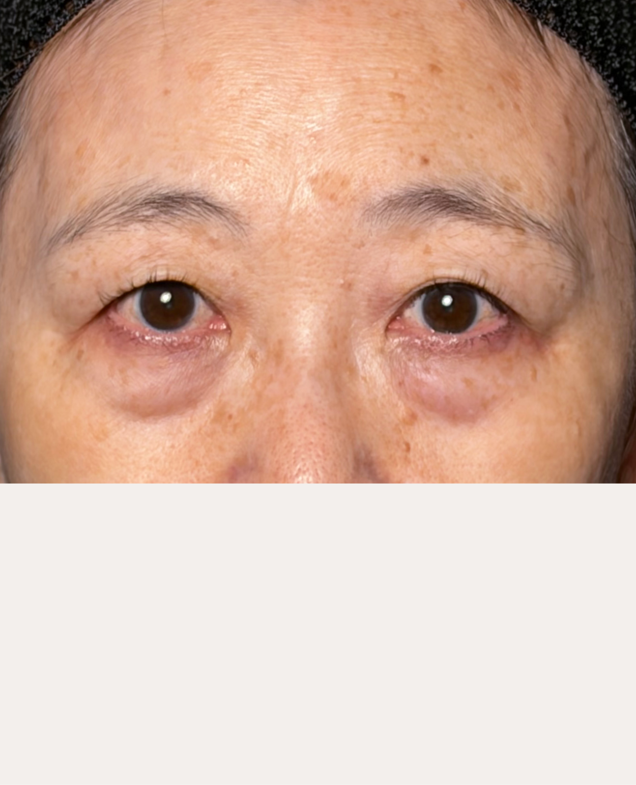 Before image